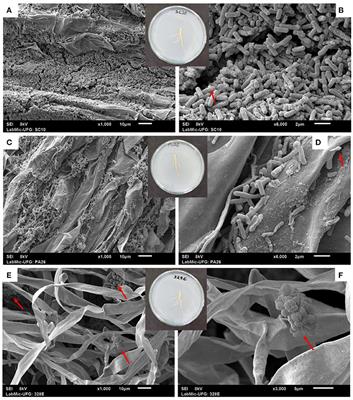 Efficiency of the Hydroponic System as an Approach to Confirm the Solubilization of CaHPO4 by Microbial Strains Using Glycine max as a Model